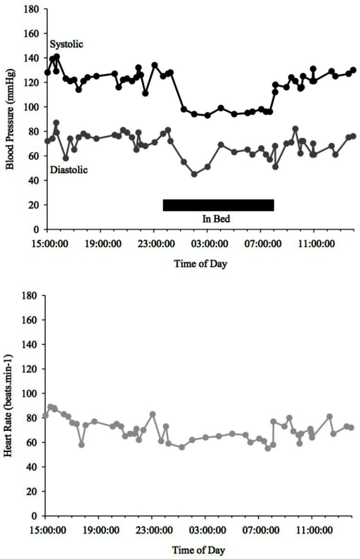 Blood Pressure (upper line systolic, lower line diastol | Open-i