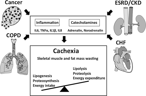 Molecular mechanisms of cachexia. Typical metabolic cha 