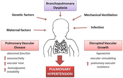 Pathophysiology of pulmonary hypertension (PH) secondar | Open-i