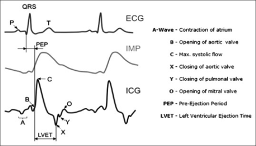 Left: Electrocardiography, impedance variation (ΔZ), a | Open-i
