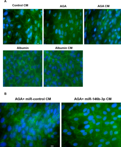 Effect Of Human Macrophages Cm On Zo 1 Pattern In Hrecs Open I