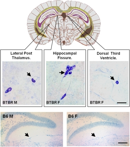 Mast cells in BTBR tissues.Diagram shows the level at w | Open-i