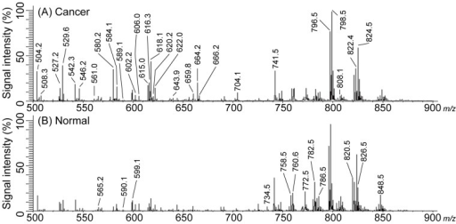 Averaged spectrum for case 1.(A) Spectrum of the cancer | Open-i