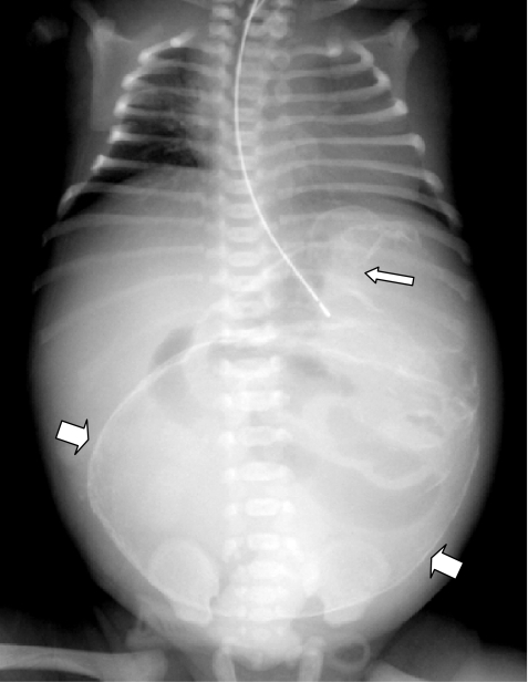 Supine radiograph of the chest and abdomen | Open-i