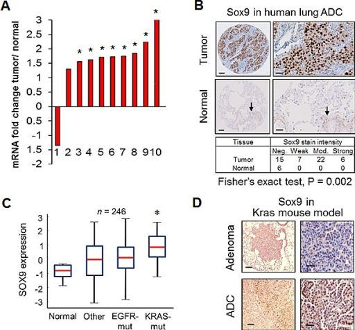 intensity median centered log2 Fold lung expression change Sox9 adenocarcinoma(A) in i