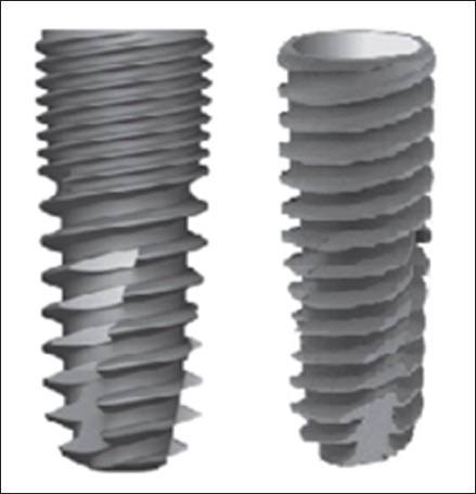 OSSTEM GS III™ and OSSTEM TS III™ Implant models | Open-i