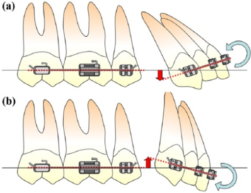 Relationship between the tendency of the anterior tooth | Open-i