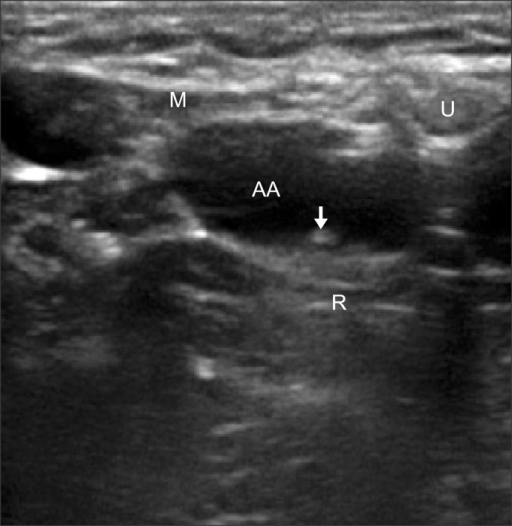 Axillary Artery Ultrasound