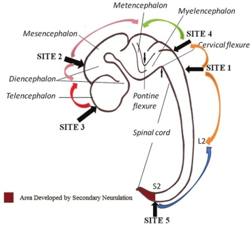 Schematic representation of “multisite closure model | Open-i