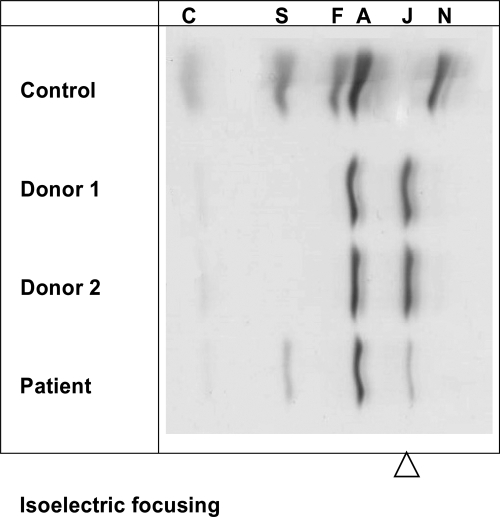 Hemoglobin Electrophoresis Isoelectric Focusing Method Open I   PMC2500260 Tcrm0403 649 03 