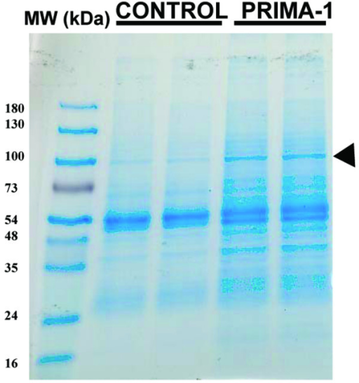 Coomassie Blue Stained Gel Of Proteins Co Immunoprecipitated With Do 1 Primary Antibody From Mda 1644