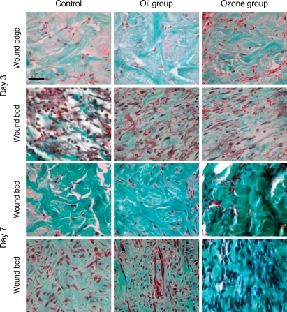 masson staining trichrome open wound openi collagen policy copyright access fibroblasts fibers comparison healing