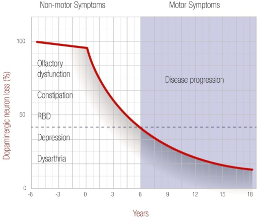 Parkinsons Disease Progression >> Progression Of Parkinson S Disease Degeneration Of Dop Open I Parkinsons Disease Progression >> Progression Of Parkinson S Disease Degeneration Of Dop Open I
