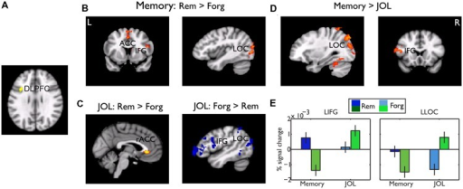 Psychophysiological Interaction Ppi Results A The Open I