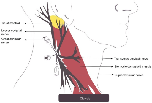 Anatomy of superficial cervical plexus of neck.Notes: N | Open-i