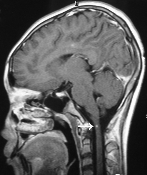 Spinal magnetic resonance imaging of the spine of the p | Open-i