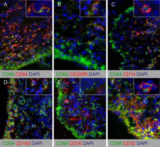 Double Immunofluorescence Stainings Of Cd68 And Macroph Open I 8838