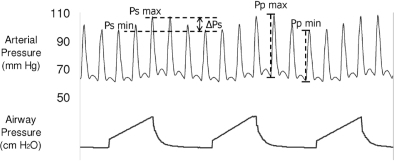 The representative trace shows the arterial pressure fl | Open-i