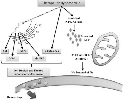 therapeutic induced hypothermia essay therapeutic induced hypothermia essay