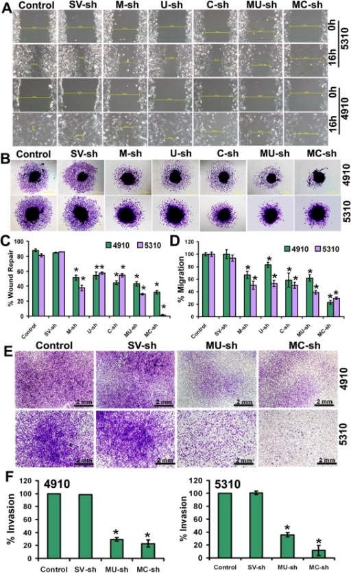 Wound Healing Spheroid Migration And Matrigel Invasion Open I