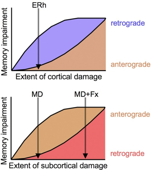 retrograde and anterograde amnesia essay retrograde and anterograde amnesia essay