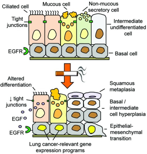 Figure 1. Basal cell (BC) origin of smoking-induced ai | Open-i