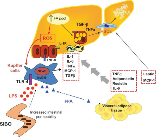 Inflammation in NAFLD. Obesity and NAFLD are directly a | Open-i