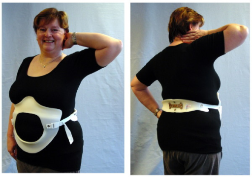 Patient wearing a physio-logic™ brace. When the brace | Open-i