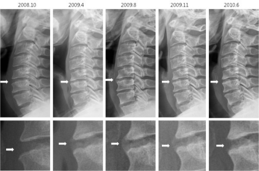 cpt x ray cervical spine