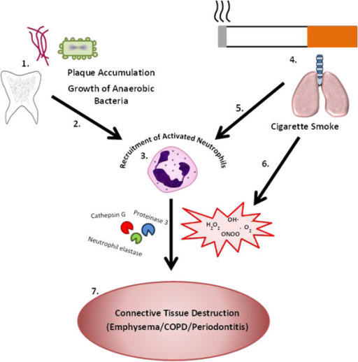 Convergence of the principal triggers of inflammation f | Open-i