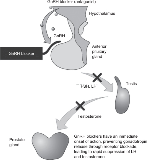 Mode of action of GnRH receptor antagonists.58 Reproduc | Open-i