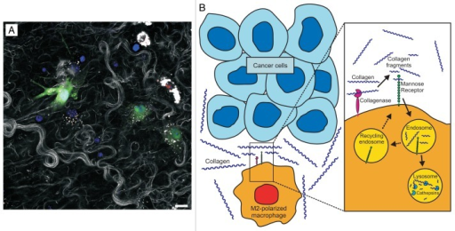 Figure 1. Proposed role of M2-polarized macrophages in | Open-i