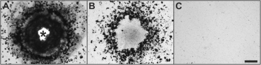 Damage of the surface of xray film caused by pressure