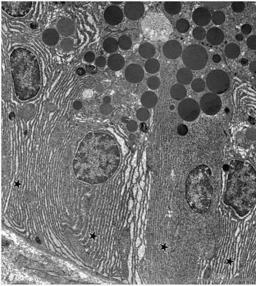 Ultrastructure Of Chief Cells In The Cgg.note The Well- 