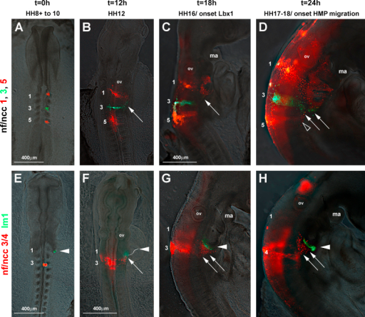 Dii Dio Mapping Of Occipital Neural Crest Cell Versus L Open I