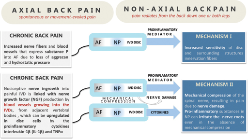 axial-and-nonaxial-back-pain-back-pain-is-an-intricate-open-i