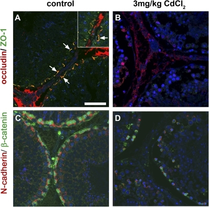 Localization of BTB proteins occludin (red) and ZO-1 (g | Open-i