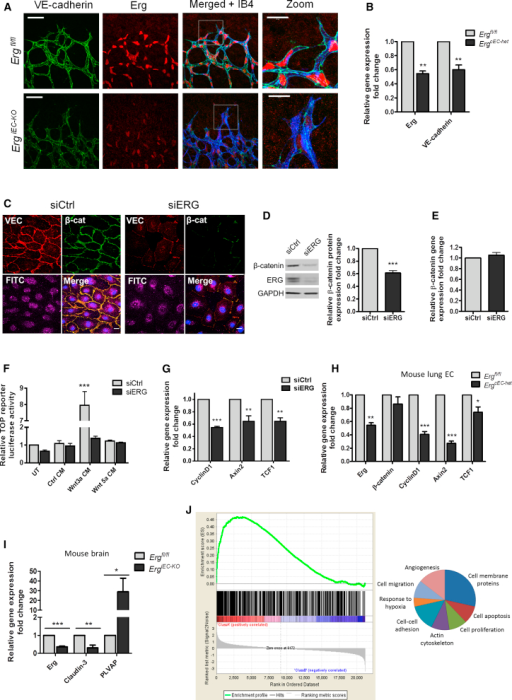 Endothelial Canonical Wnt Signaling and β-Catenin Stab | Open-i