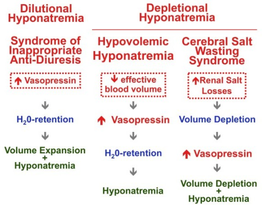 Mechanisms underlying hypotonic hyponatremia. In most c | Open-i