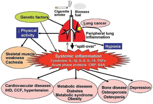 Systemic inflammation – spill over hypothesis. (In a  Open-i