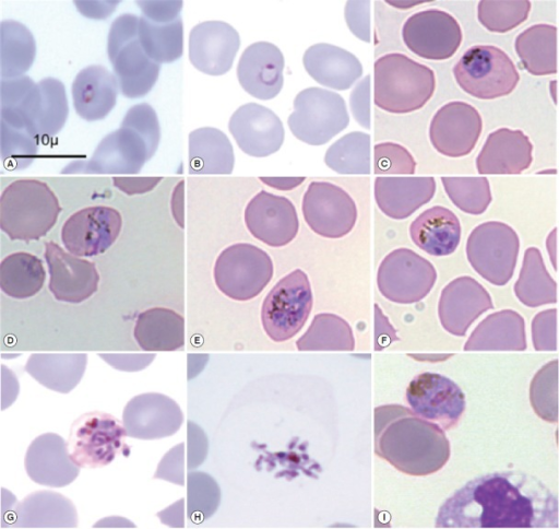 Microscopic morphology of Plasmodium knowlesi in May-Gr | Open-i