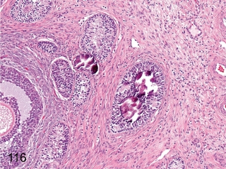 Ovary: Mineralization. Primordial follicles and early s | Open-i