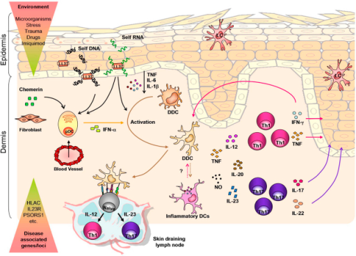 A DC perspective on psoriasis pathogenesis. A combinati | Open-i