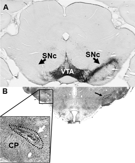 Nigral and subthalamic lesions.(A) Depletion of TH-immu | Open-i