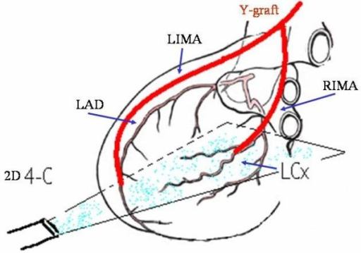 architecture-of-the-y-g-with-the-distal-lima-and-rima-c-open-i