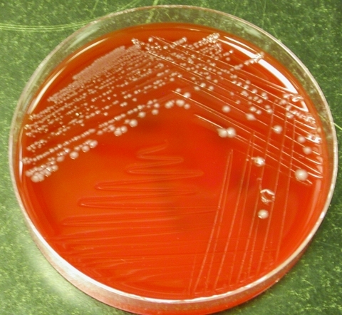 Colonial morphology of Clostridium hathewayi on brucell | Open-i