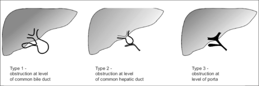 Types Of Biliary Atresia Open I