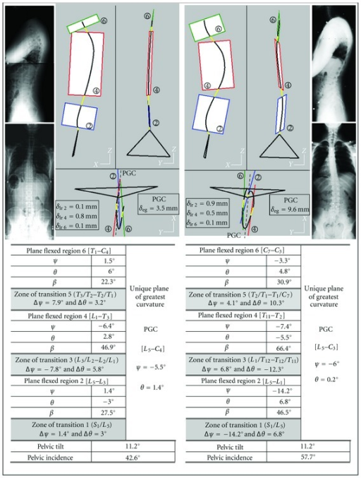 compare and contrast structural and nonstructural curvatures of the spine Functional or structural scoliosis lumbar orthopedic tests / lumbar special tests: includes purpose, procedure, positive sign: kernig's test quadratus lumborum length test scoliosis short leg test scoliosis small hemipelvis test. compare and contrast structural and nonstructural curvatures of the spine Functional or structural scoliosis lumbar orthopedic tests / lumbar special tests: includes purpose, procedure, positive sign: kernig's test quadratus lumborum length test scoliosis short leg test scoliosis small hemipelvis test.