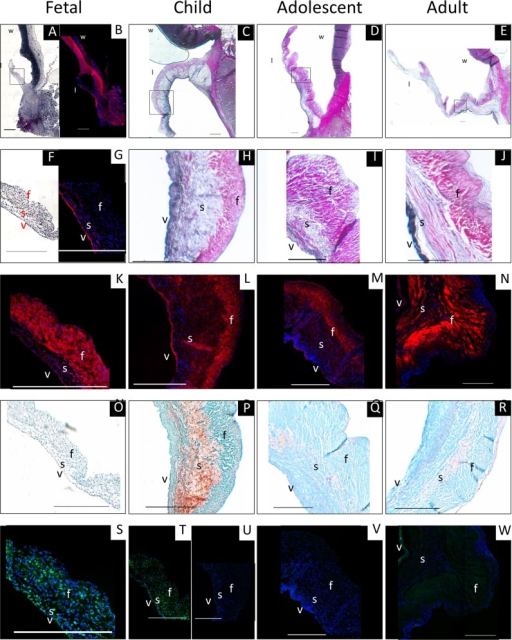 atrioventricular valve histology