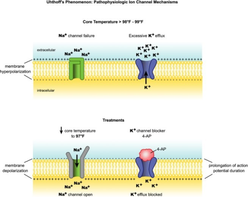 Ion channel pathophysiology in MS. pathophysiological m | Open-i